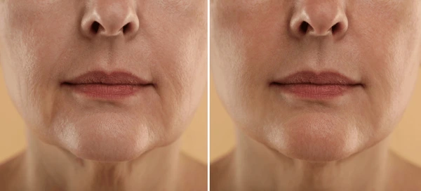 10 Tips Anti-Aging untuk Area Dagu dan Leher