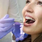 5 Tips Menjaga Lidah Bagi Kamu yang Pakai Behel
