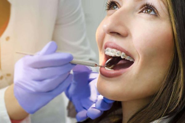 5 Tips Menjaga Lidah Bagi Kamu yang Pakai Behel