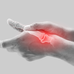 10 Hal yang Bisa Dilakukan untuk Meredakan Nyeri Jari