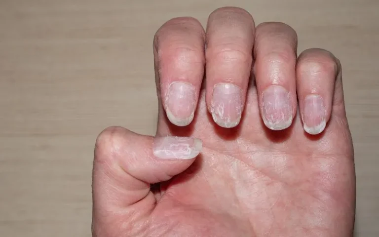 10 Cara Agar Kuku Tidak Mudah Terbelah