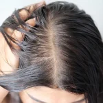 10 Tips Rambut Anti Lepek Buat Kamu yang Punya Kulit Kepala Berminyak