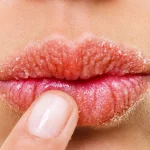 7 Langkah Menghindari Alergi Produk Bibir