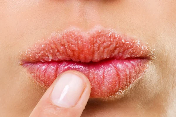 7 Langkah Menghindari Alergi Produk Bibir